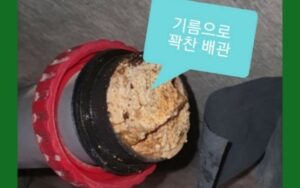 혼합 유지방의 무서움, 정밀 진단으로 확인