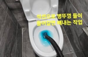 석션으로 이물질 흡입