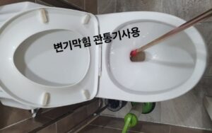 도기 탈거 없는 완벽한 역견인 스케일링