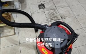 이물질을 밖으로 빼내는 석션 작업